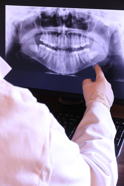 Best Walk-In Emergency Dental Services in Los Ranchos, CA