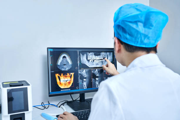 Best Emergency Treatment for Oral Infections in Los Ranchos, CA